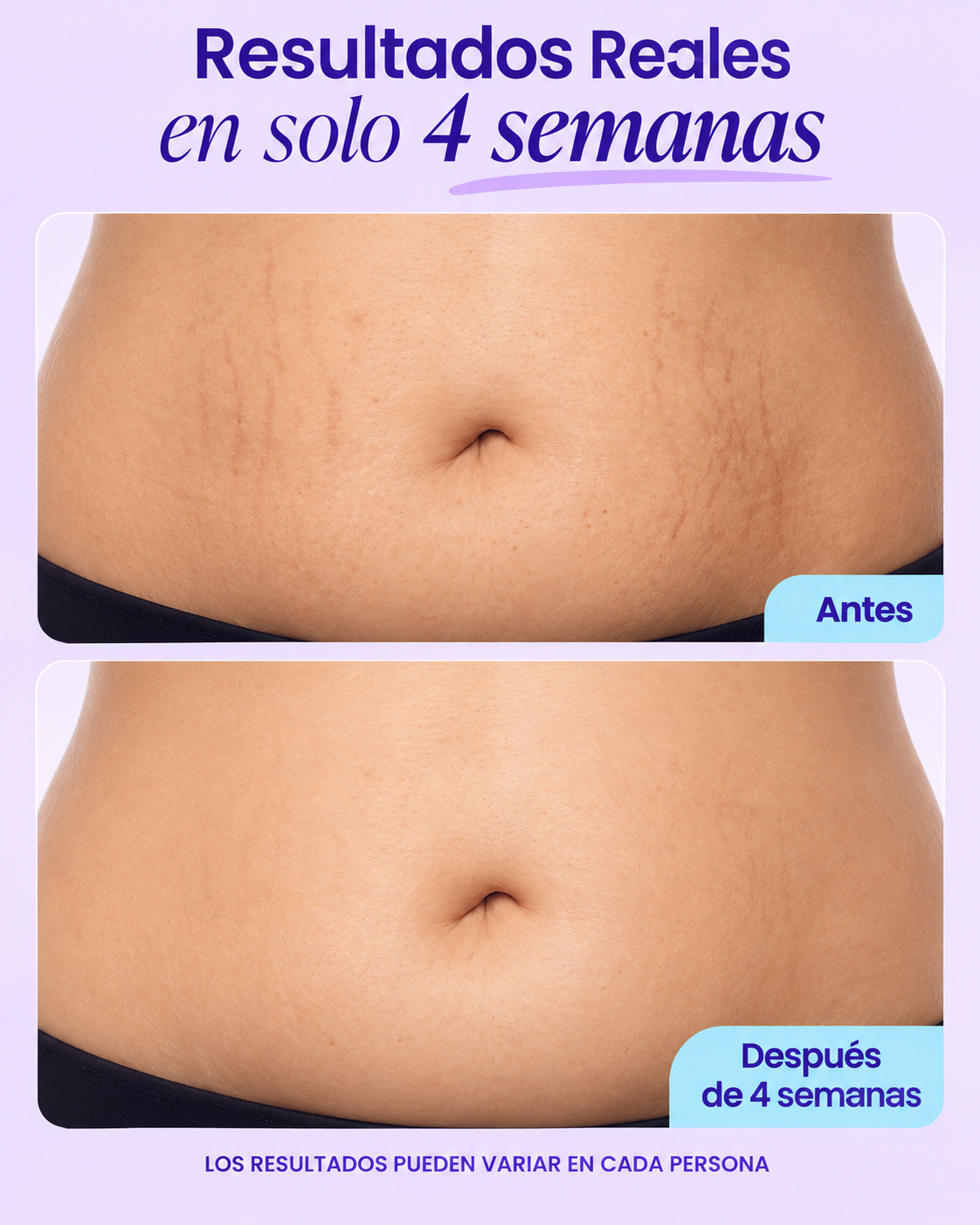 Crema Reafirmante y Alisadora para el Vientre GOBELLY